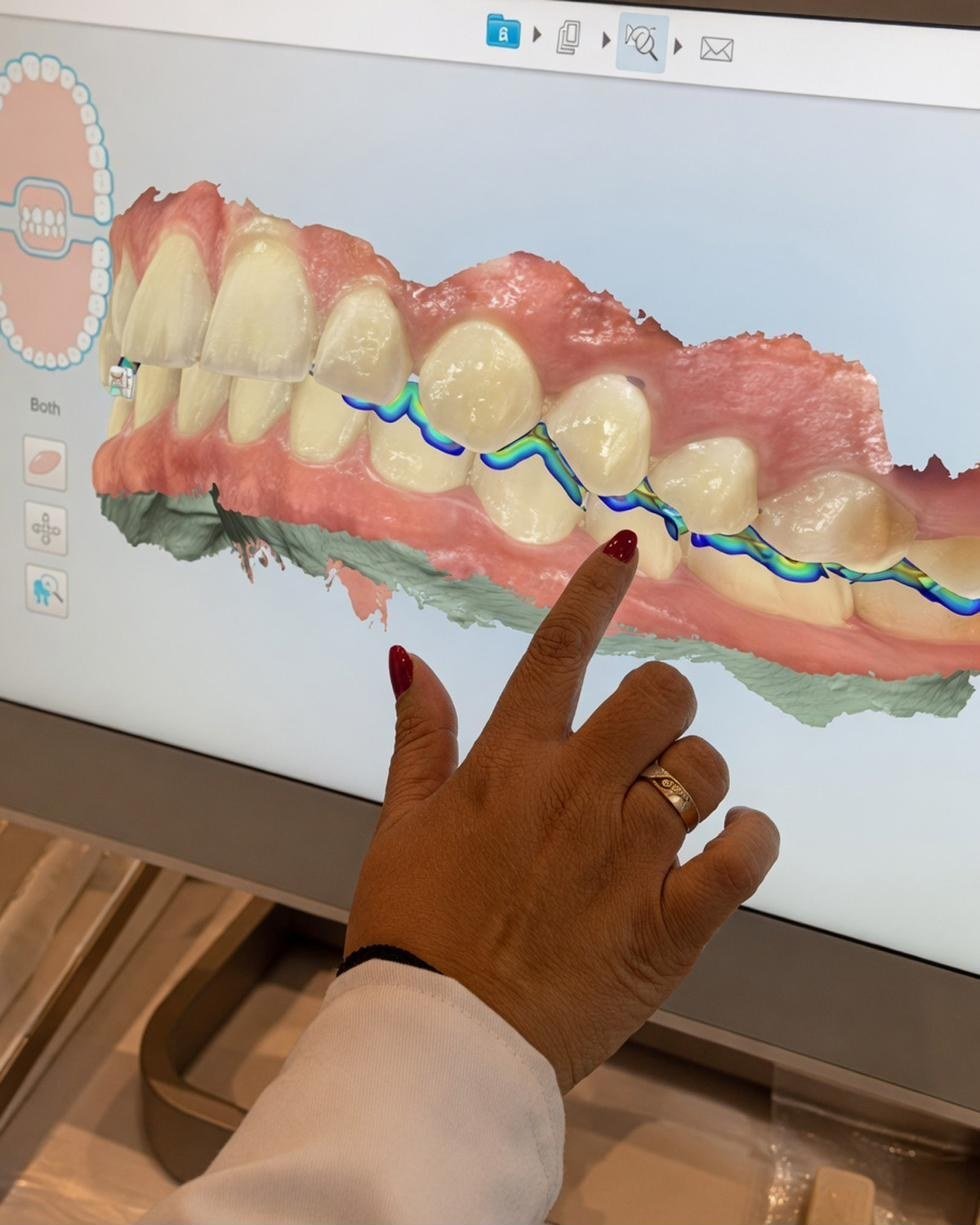 Odontología biológica - escáner 3Shape
